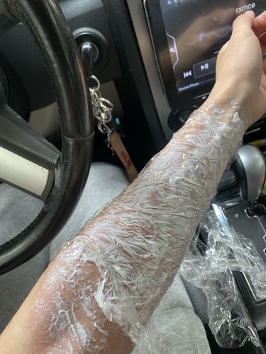 Customer photo review of Signature Tattoo Numbing Cream
