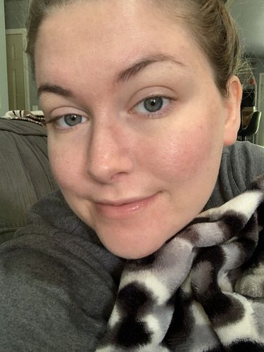 Customer photo review of AntiÅldrandeSkönhet™ Concealer Stift