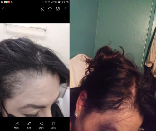 Customer photo review of TillväxtExtract™