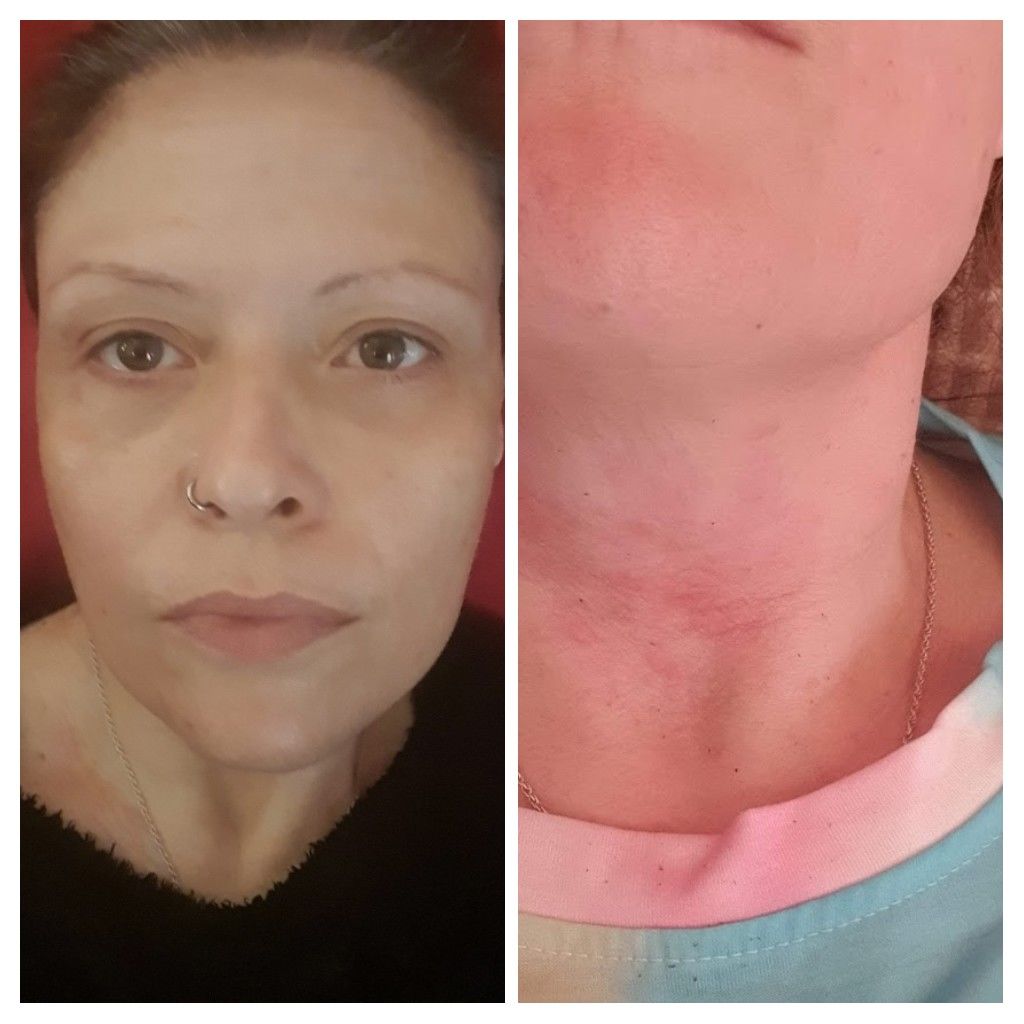 Customer photo review of Anti Ageing Serum