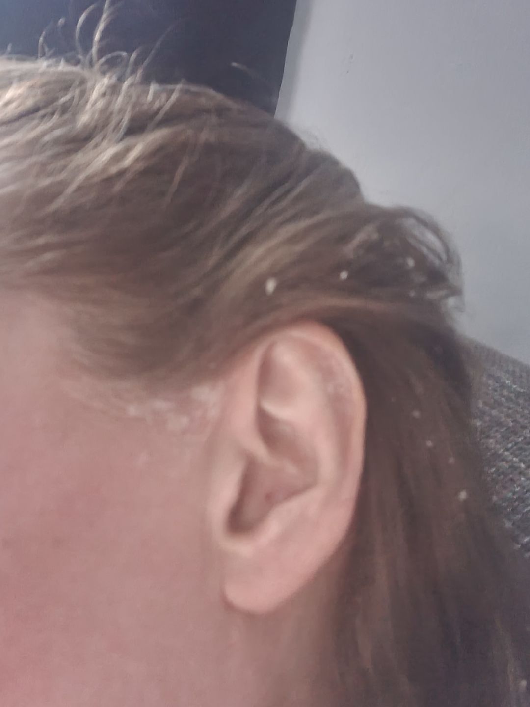 Customer photo review of Scalp Oil