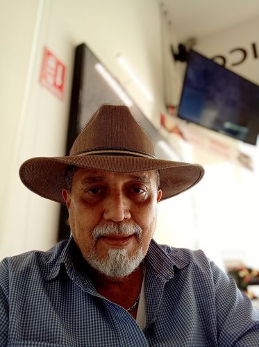 Customer photo review of 3×2 Llévate 3 y paga 2 Minoxidil 15% 100 ml + 1 Aceite  Premium Gratis