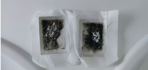 Customer photo review of DétoxCare® | Patchs détox pieds