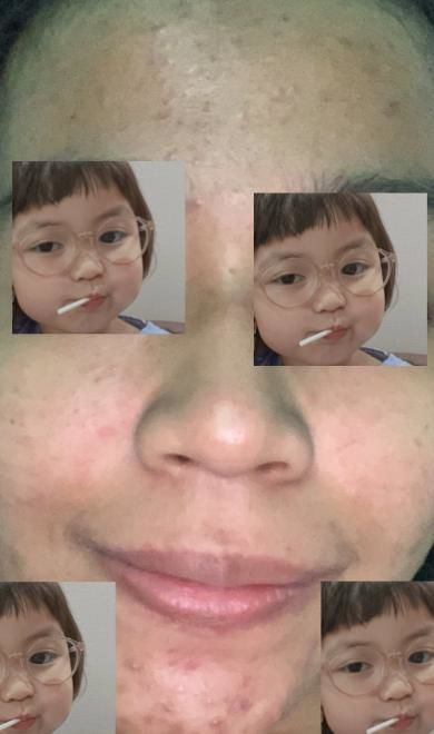 Customer photo review of GOLD FACE SET