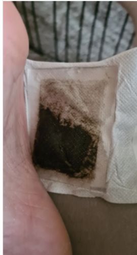 Customer photo review of DétoxCare® | Patchs détox pieds