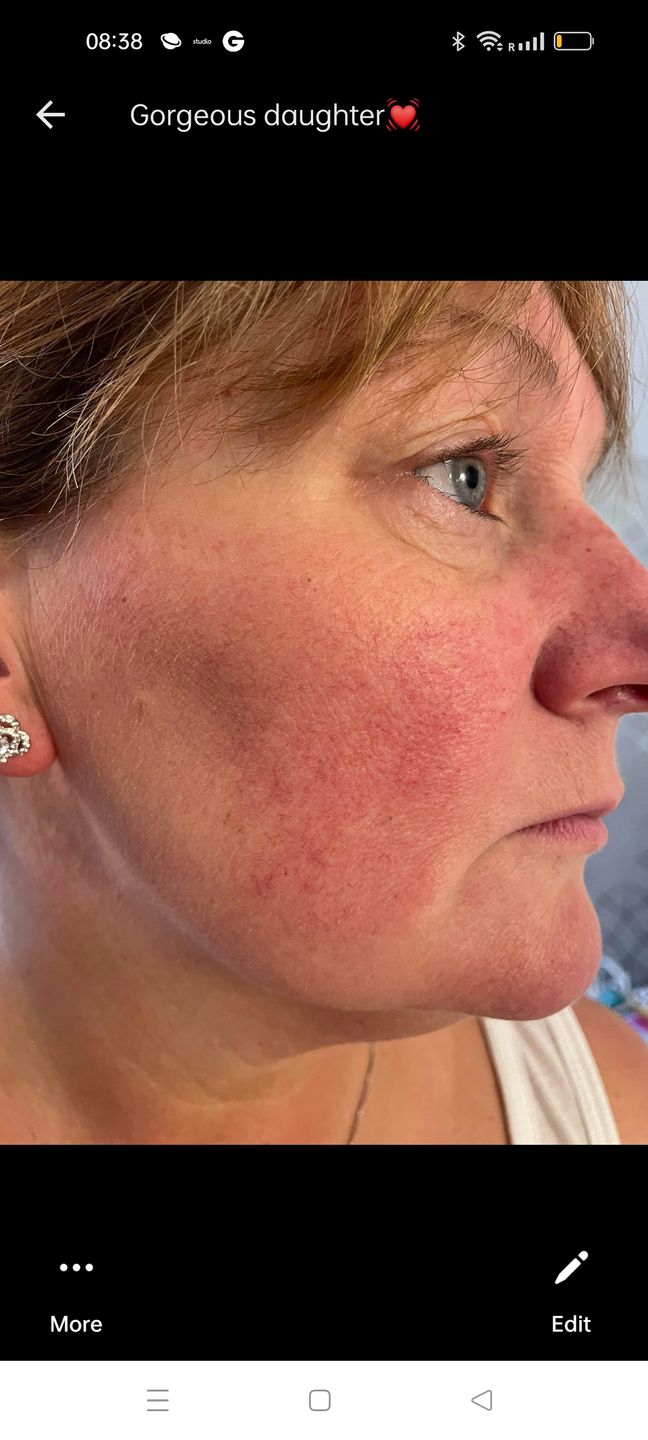 Customer photo review of Healing Miracle Cream
