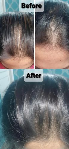 Customer photo review of Growth & Shine Hair Oil