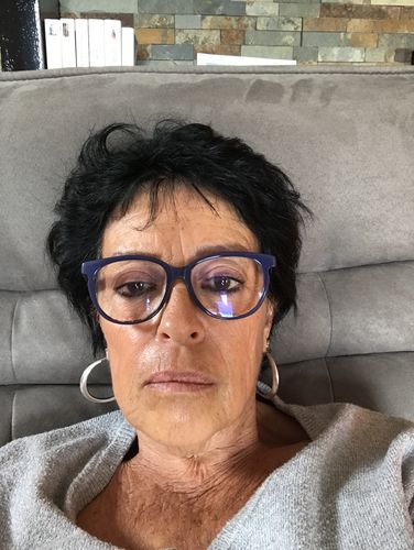 Customer photo review of Sarahbio - huile de pépins de figue de barbarie - 30 mL