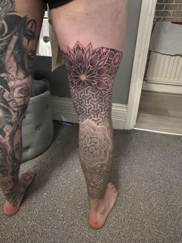 Customer photo review of TattooNumbx Numbing Cream