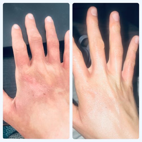 Customer photo review of ÄrrSerum™