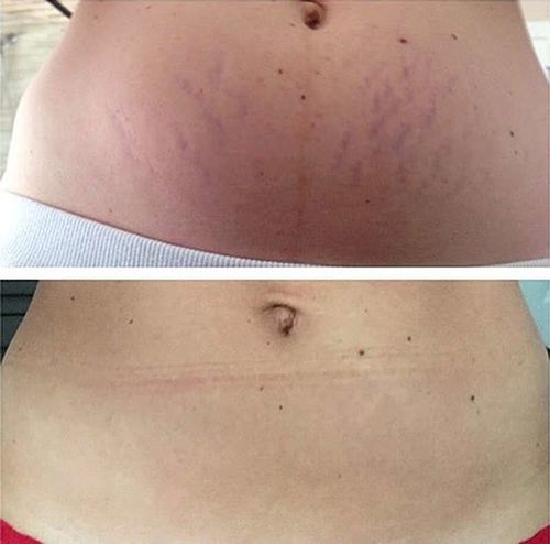 Customer photo review of ÄrrSerum™
