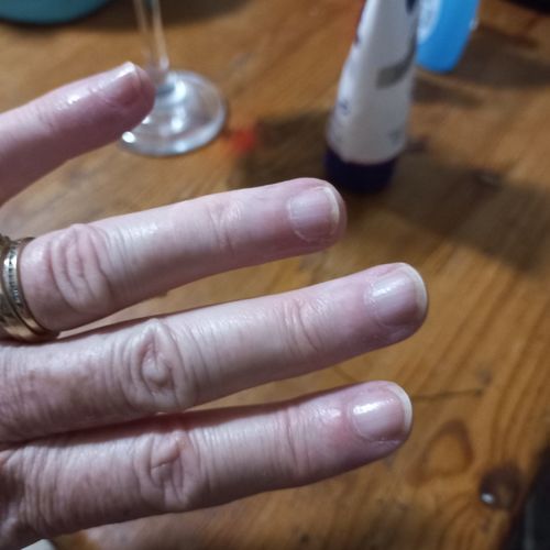 Customer photo review of Hair & Nail Herbs Tincture