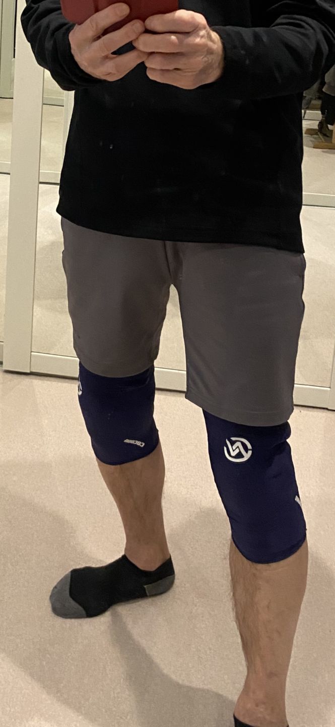 Customer photo review of IceHug - Cold Compression Sleeve