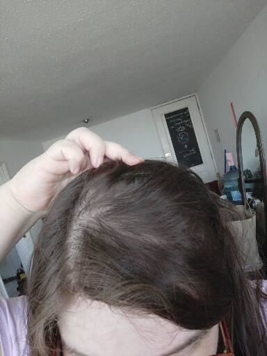 Customer photo review of Shampoo DETOX y pelo graso