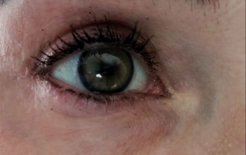 Customer photo review of Neala Green Contact Lenses(12 months wear)