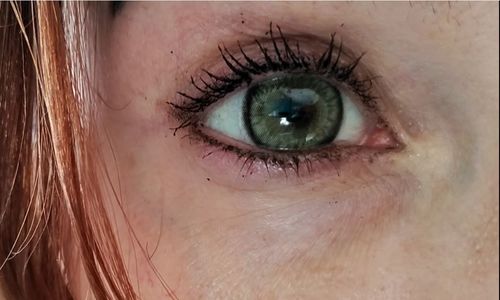 Customer photo review of Norko Green Contact Lenses(12 months wear)