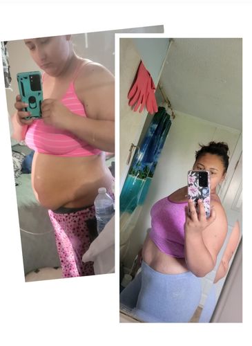 Customer photo review of BantningsPlåster™