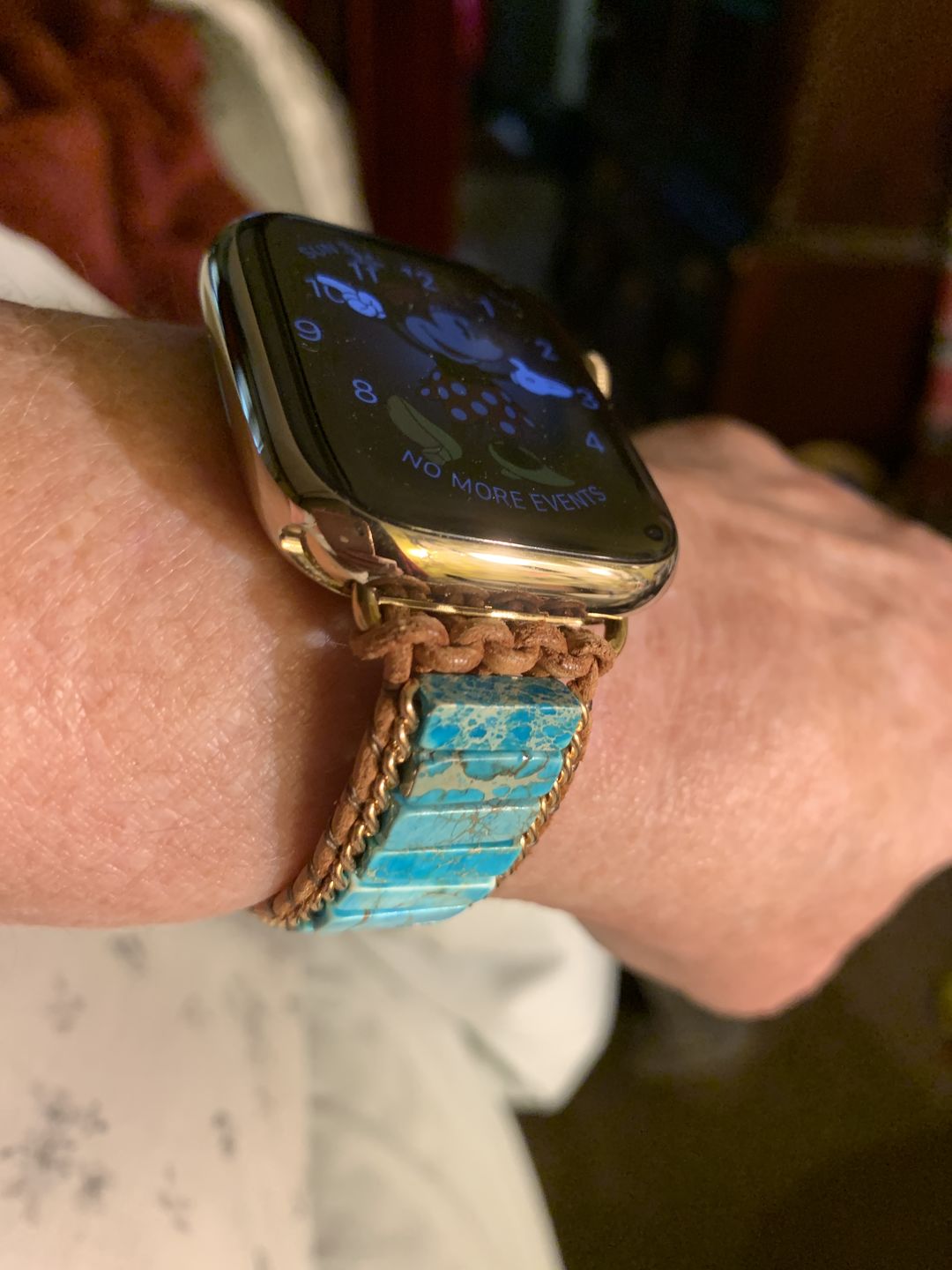 Customer photo review of Native Turquoise Protection Apple Watch Strap