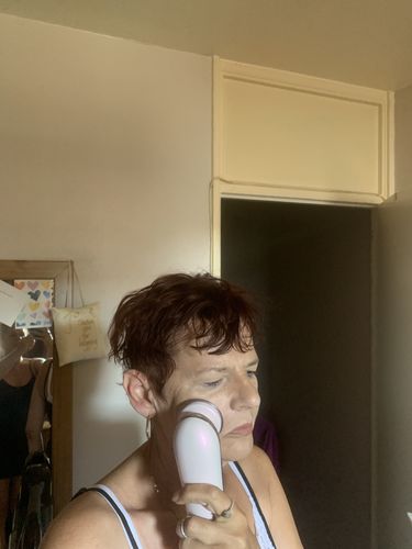 Customer photo review of EvenSkyn® Lumo: Premium Anti-Aging & Skin Tightening Handset