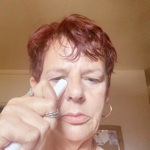 Customer photo review of EvenSkyn® Venus: Premium Eyelid Anti-Aging Device