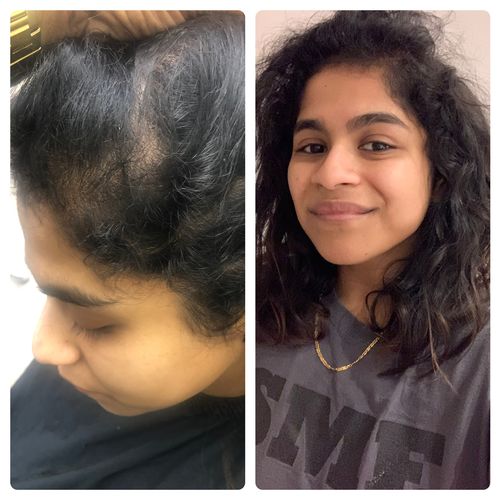 Customer photo review of Genesis