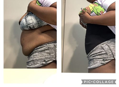 Customer photo review of Wrap Waist Trainer and Shaper