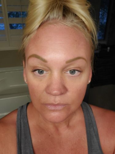 Customer photo review of Beautylift™ Reusable Silicone Patches