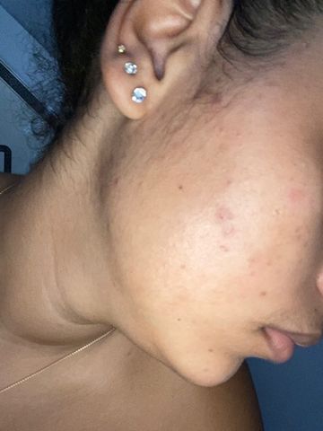Customer photo review of Good Clean - 3 mois