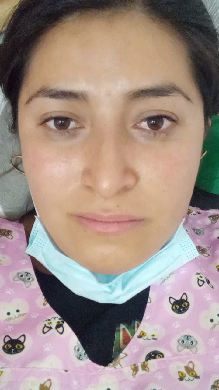 Customer photo review of Sleeping Mask / Mascarilla de Noche - Bakuchiol & Zapote Negro