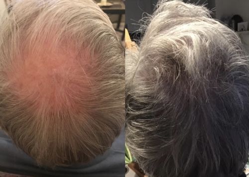 Customer photo review of Inches - Hair & Beard Oil