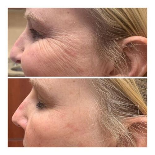 Customer photo review of Dermasoie Masque-Sérum Nuit Liftant