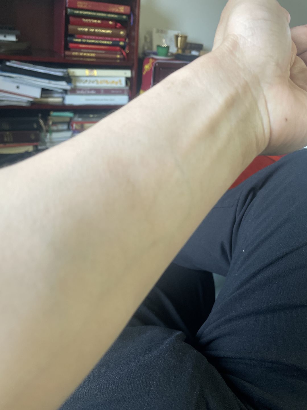 Customer photo review of Omic LightenUp PLUS Lightening Body Lotion - 400ml