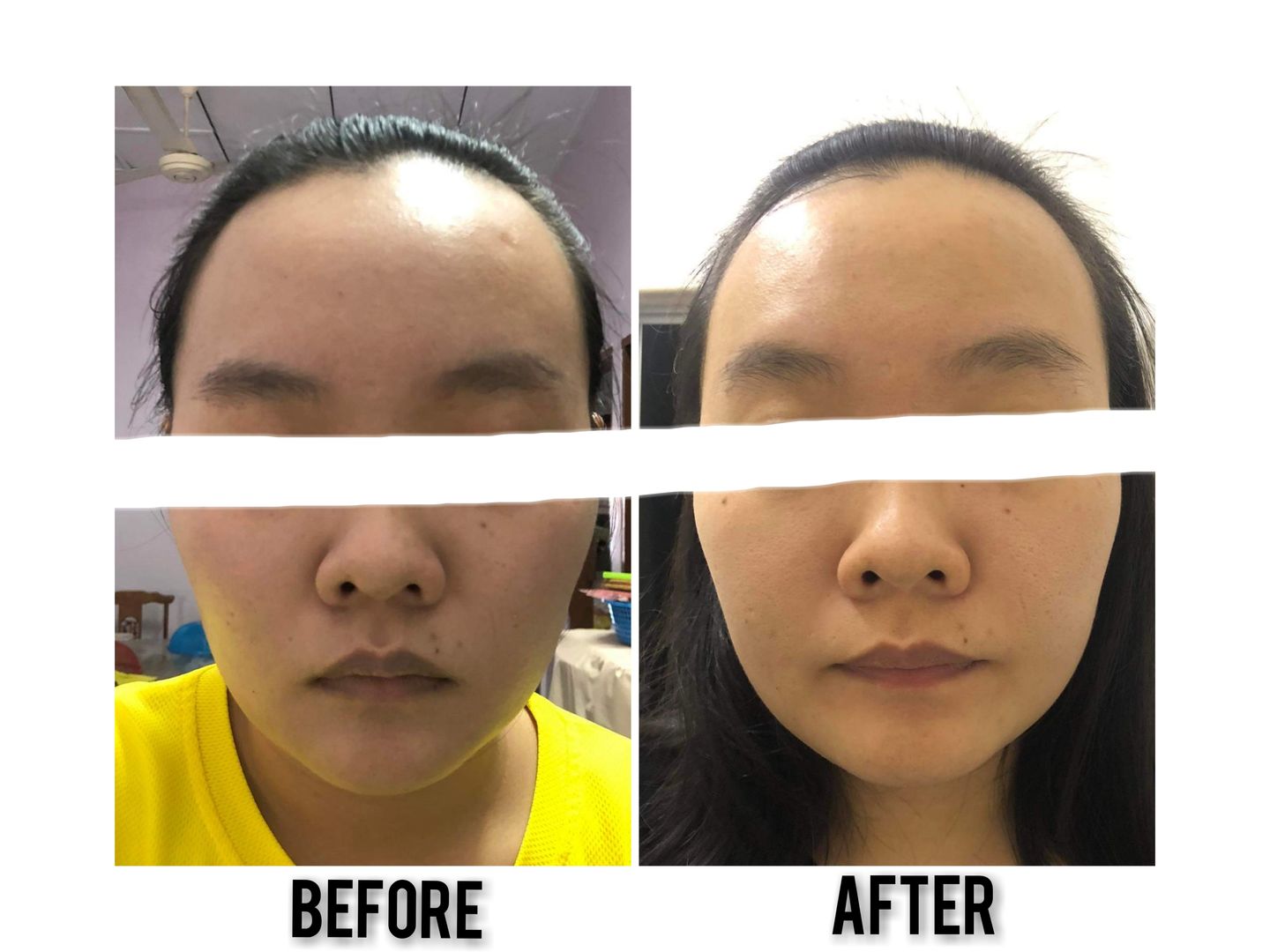 Customer photo review of CLEF RADIANT GOLD ESSENCE (30ml)
