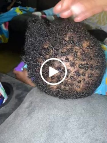 Customer video review of Kid's Super healthy Hair kit
