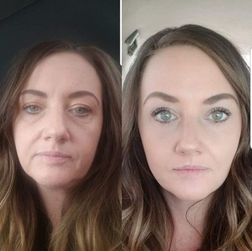 Customer photo review of Dermasoie Masque-Sérum Nuit Liftant