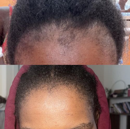 Customer photo review of Inches - Hair & Beard Oil