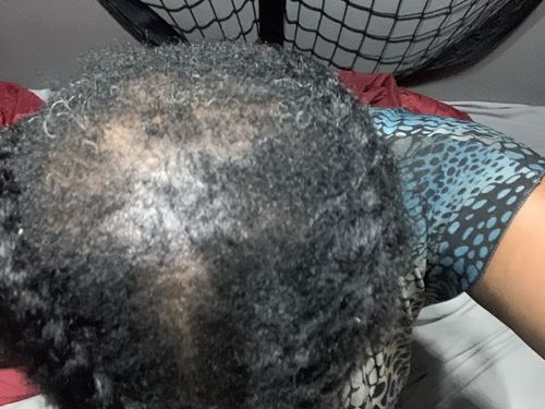 Customer photo review of Holistic Scalp Cream