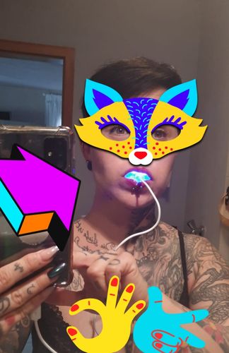 Customer photo review of PAP+ LED Teeth Whitening Kit