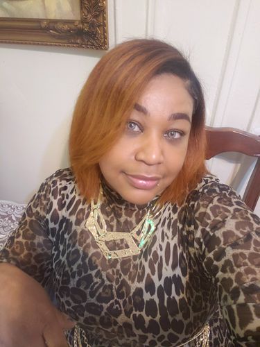 Customer photo review of Citha Hazel Contact Lenses(12 months wear)