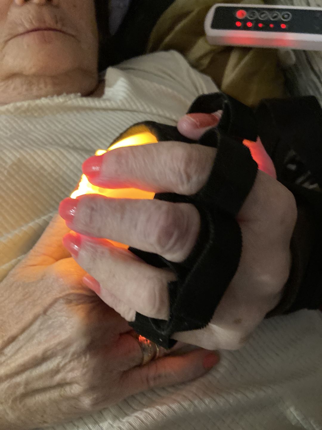 Customer photo review of VibroGrip - Ujjrehabilitációs Fizioterápiás Vibráló Labda