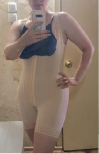 Customer photo review of HIGH DOUBLE COMPRESSION GARMENT ABDOMEN CONTROL HOOK AND EYE CLOSURE TUMMY CONTROL ADJUSTABLE BODYSUIT