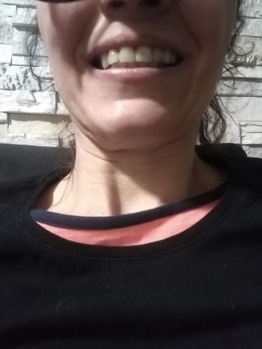 Customer photo review of Teeth-Veneer 2.0