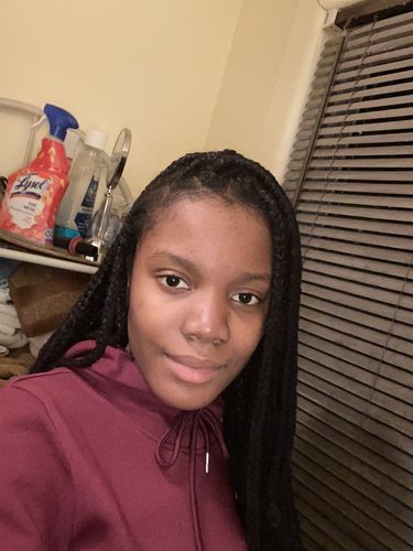 Customer photo review of Rice Water Scalp Mist (PreMade)
