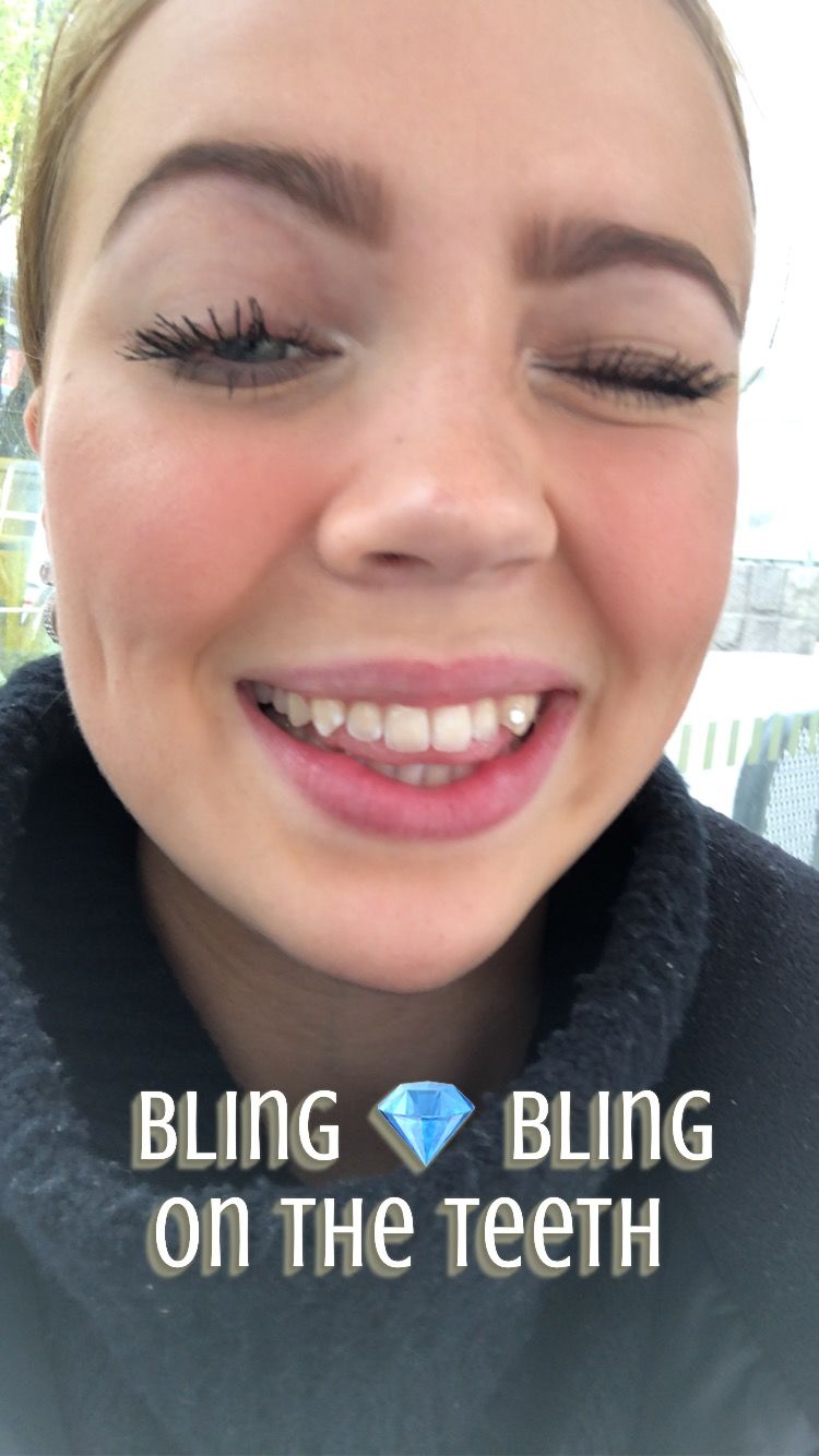 Customer photo review of Crystal Clear 2.7mm 5-pack