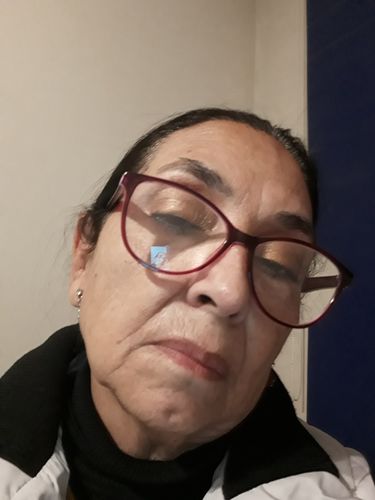 Customer photo review of Pack Hidro-K Día + Hidro-K Noche + Antiox+