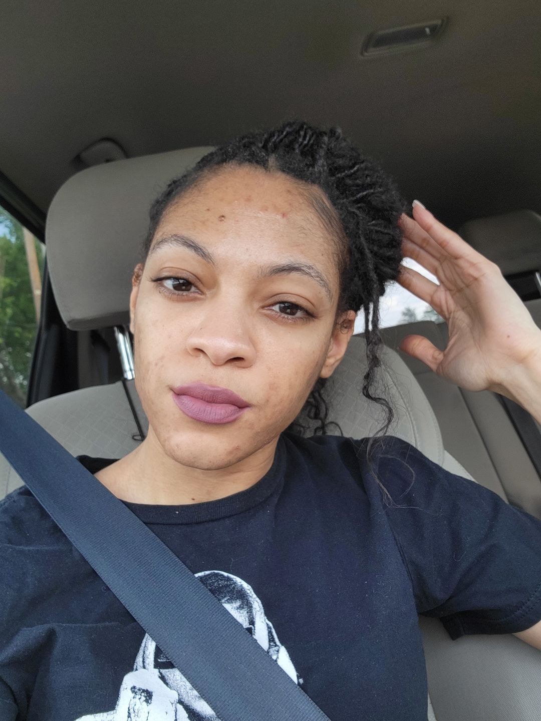 Customer photo review of HYDRATING MOISTURIZER