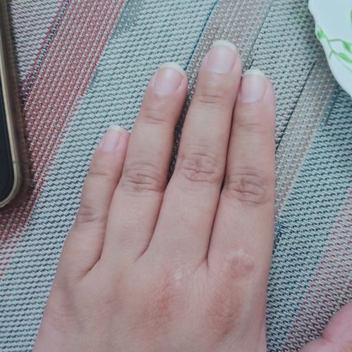 Customer photo review of Ultra Body Butter