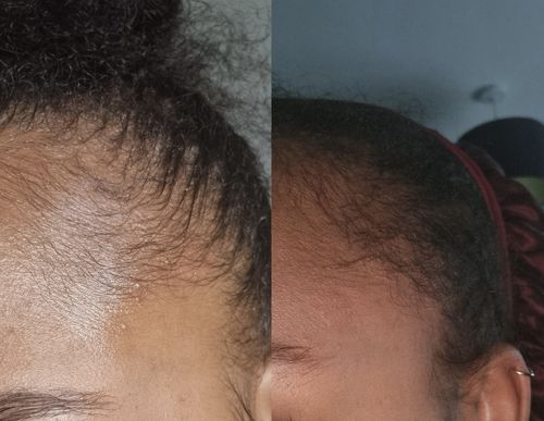 Customer photo review of Oasis