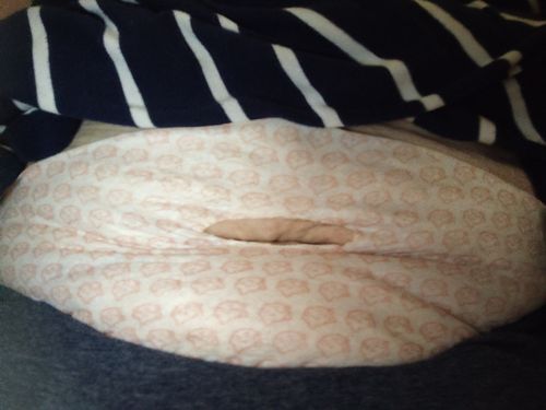 Customer photo review of Wonder Slim Patch