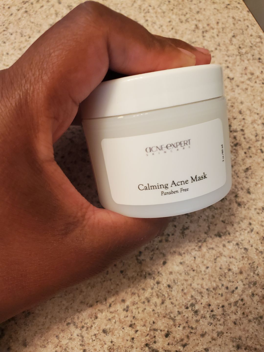 Customer photo review of CALMING ACNE MASK